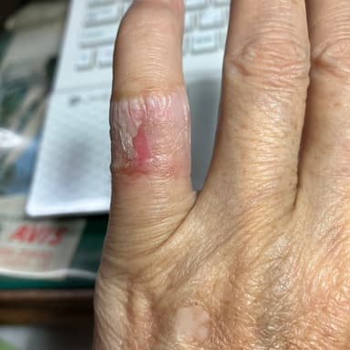 病気やケガは自然治癒力で治す　地球で薬を使う者は人間だけ